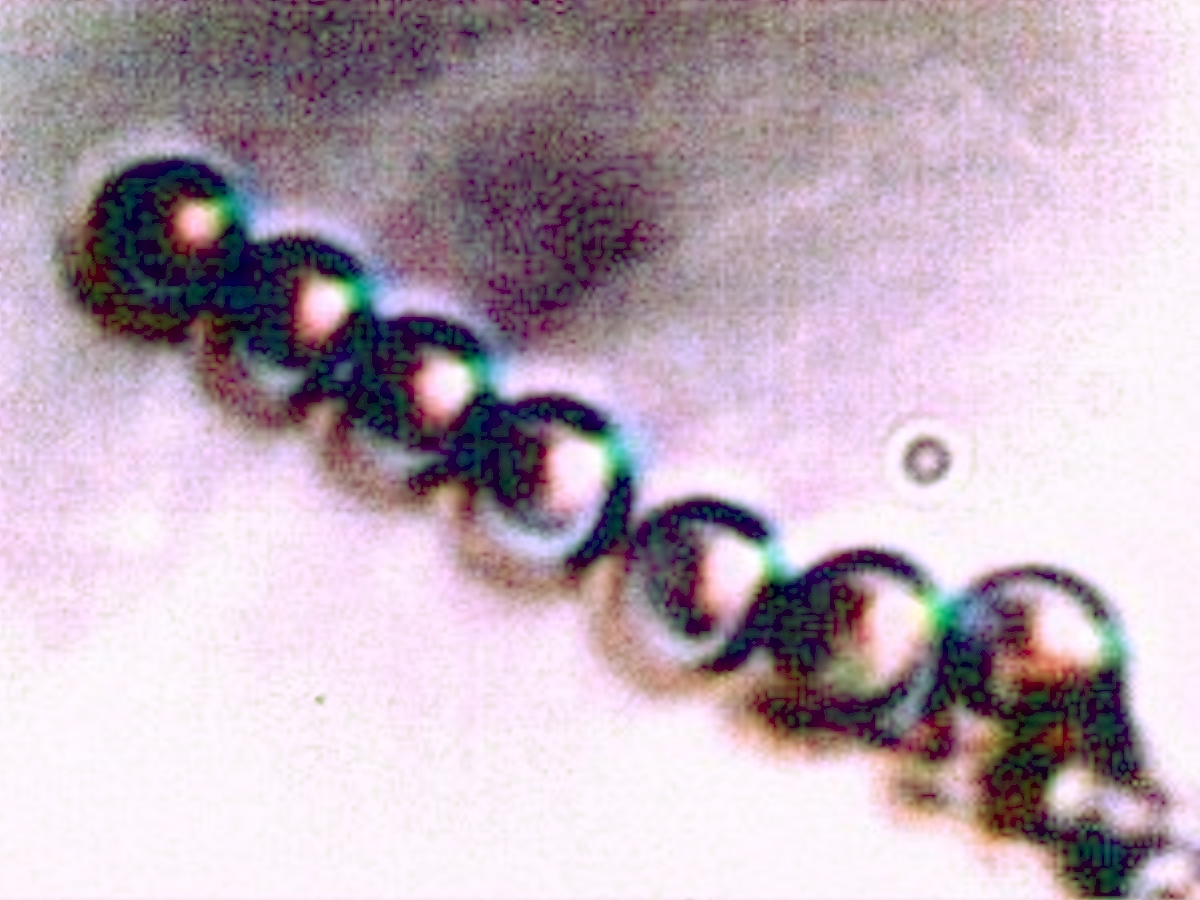 Filament - Erythrocyte 