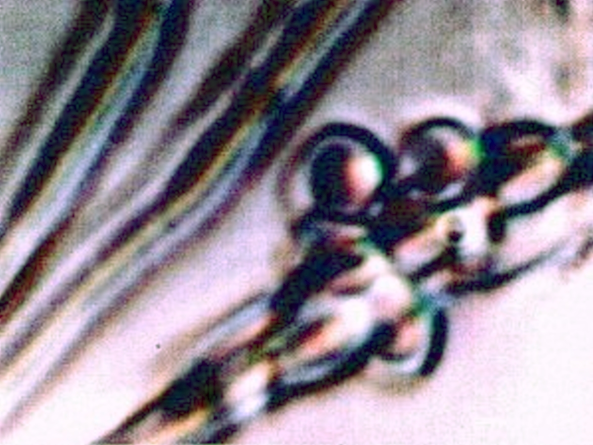 Filament - Erythrocyte 