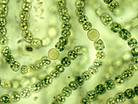 filamentous cyanobacteria