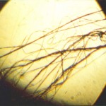 miccheb2 fibers